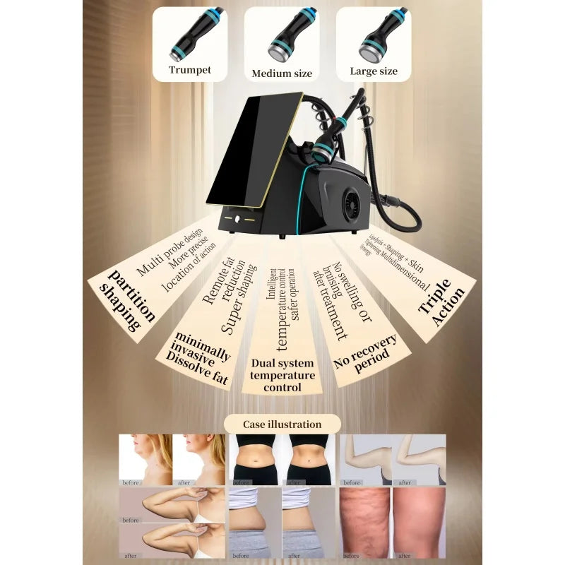 Onda Ice Microwave Skin Tightening Device for Body Contouring