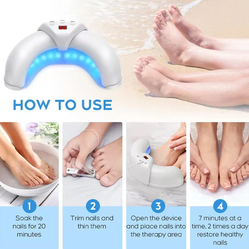 Fungal Nail Laser Device For Toenail Fungus Treatment