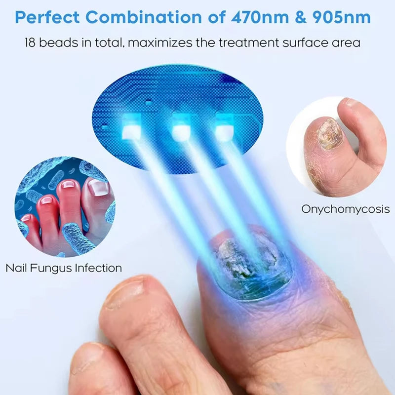 Fungal Nail Laser Device For Toenail Fungus Treatment